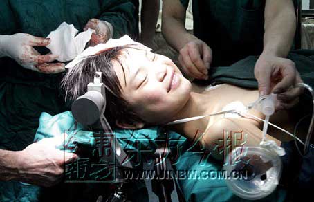 国内首例全程清醒开颅手术新乡完成